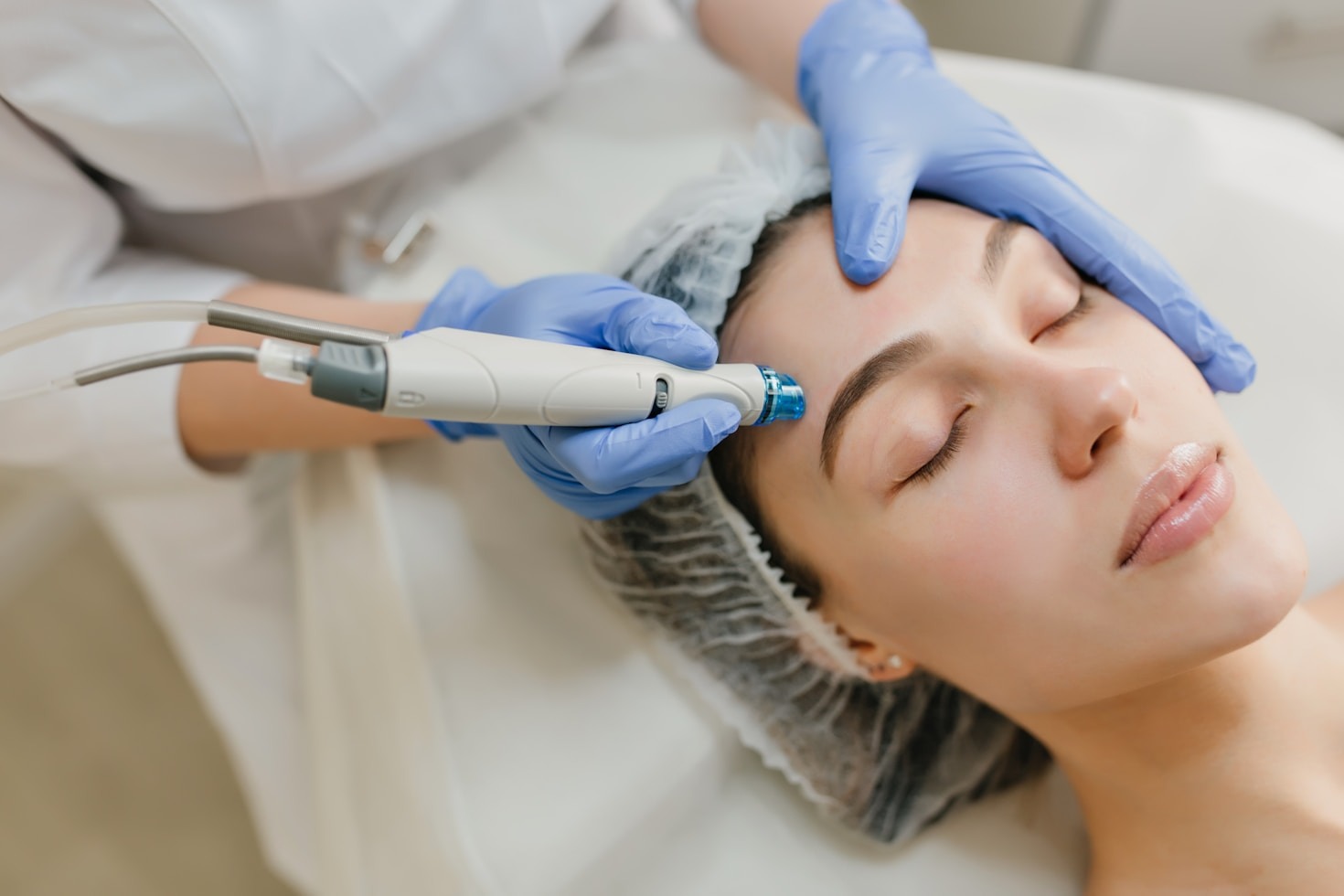 Como o botox pode rejuvenescer sua aparência